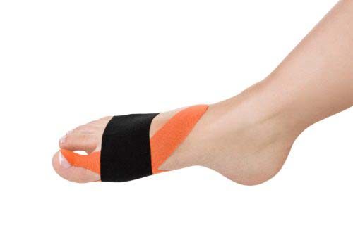qmed kinesio tape tasma do kinesiotapingu aplikacja na hallux e1507650021629 1